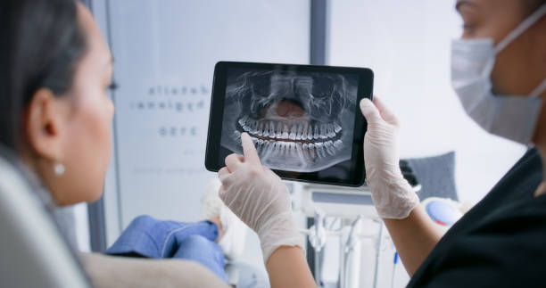 Licensed Wisdom Tooth Removal service in North Plymouth, MA - Smile Center Dentistry